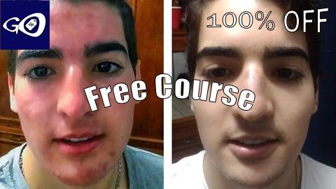 Free Coupon Acne: Effective Solution from the Root [100% OFF]
